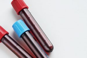 ampola de sangue para teste de HIV