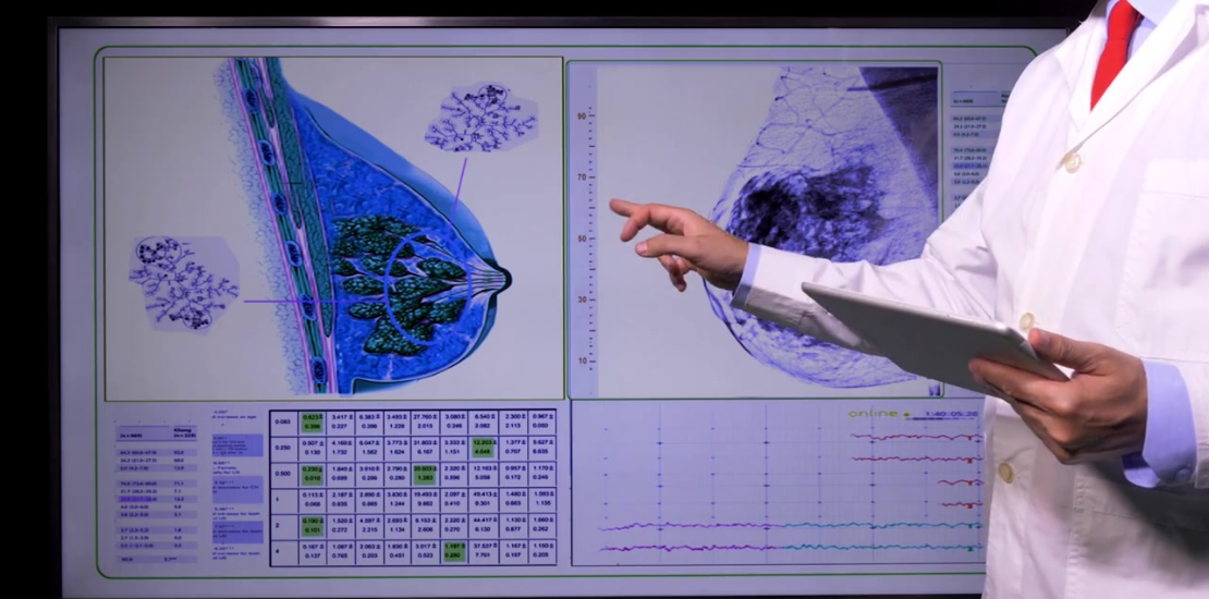 Programa de Qualidade em Mamografia teve projeto-piloto desenvolvido pelo INCA em parceria com Anvisa e Colégio Brasileiro de Radiologia - CBR